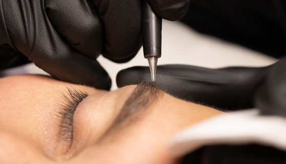Many Korean men are opting for scalp and eyebrow tattoos to improve their appearances and tackle their long-held insecurities with much cheaper and simpler procedures than hair transplants. [SHUTTERSTOCK]