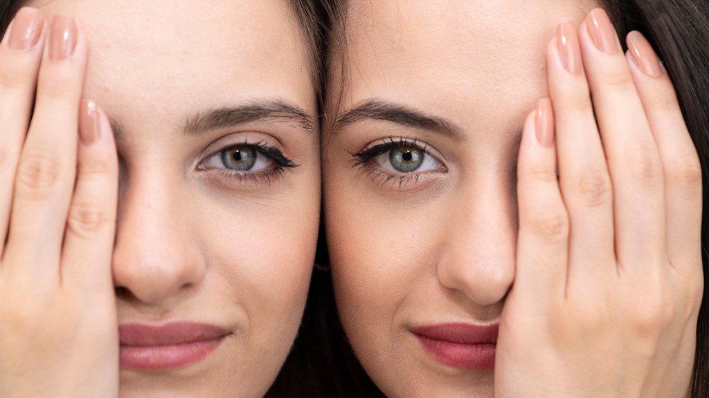 Two twin sisters with different canthal tilts to their eyes