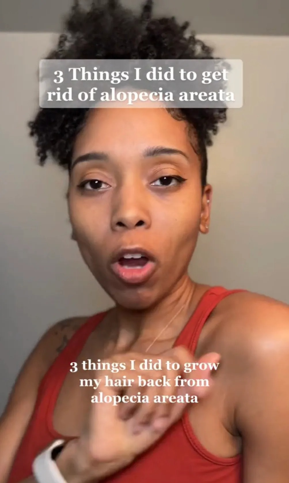 Nilsa has gone viral on TikTok after revealing how she regrew her hair after being diagnosed with alopecia areata