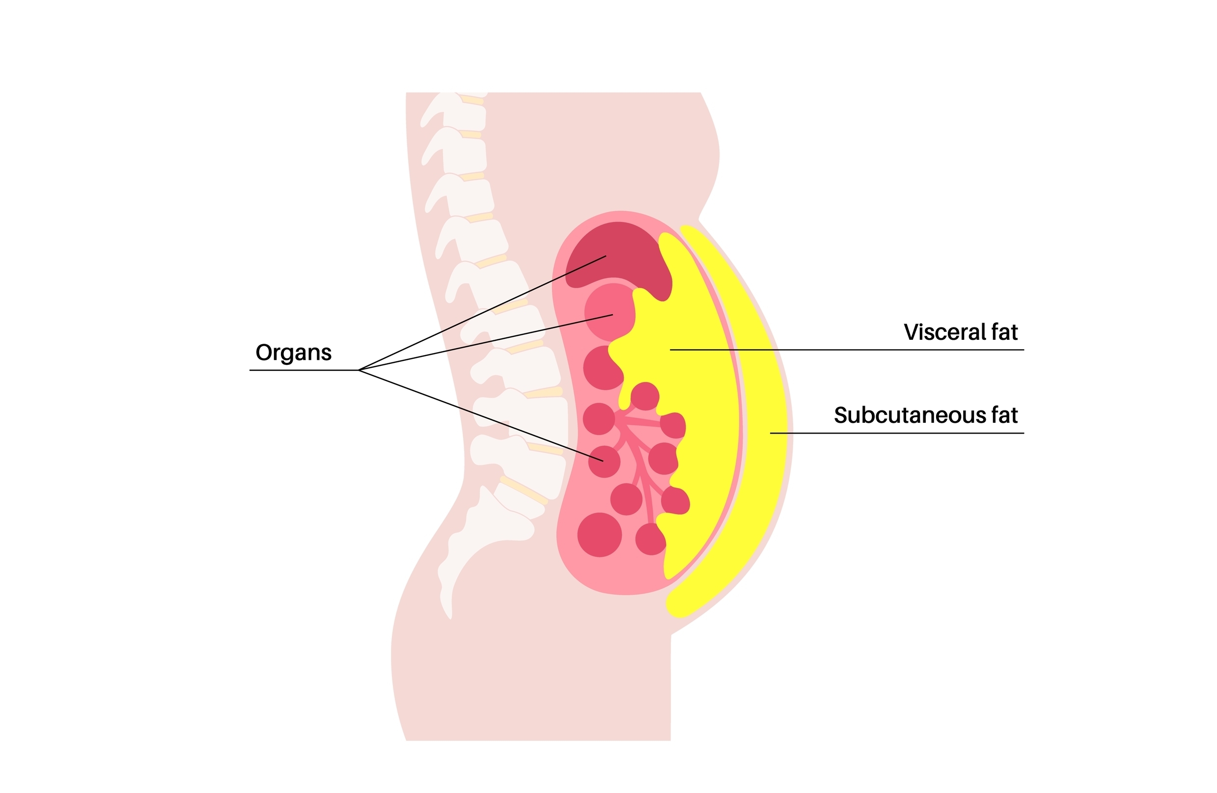 Visceral vs subcutaneous fat diagram