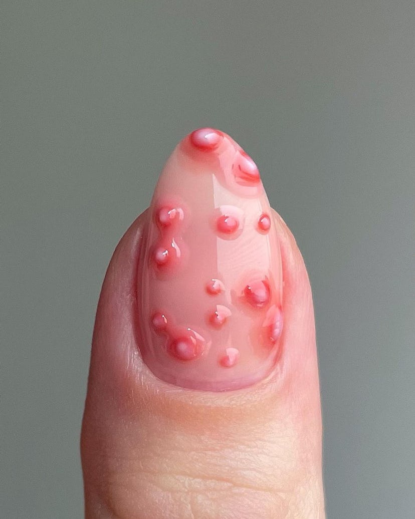 Realistic acne nail art