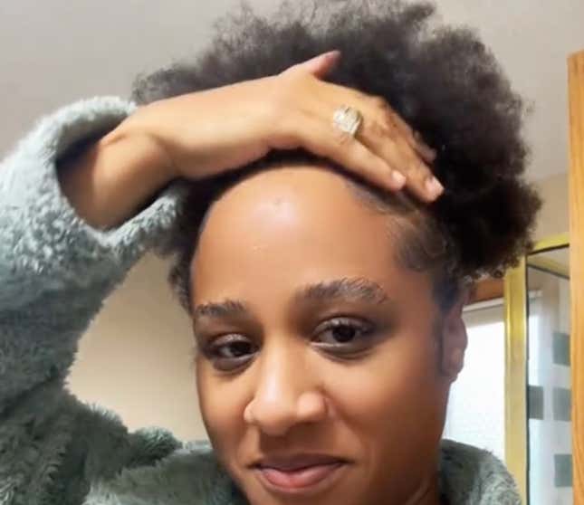 Image for article titled Black Women Using Rogaine to Regrow Their Edges Share Amazing Before, After Pics on Tiktok