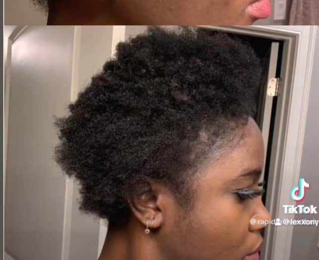 Image for article titled Black Women Using Rogaine to Regrow Their Edges Share Amazing Before, After Pics on Tiktok